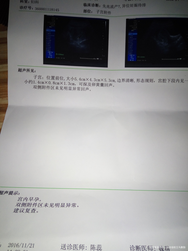 最近一直有褐色分泌物怎么办