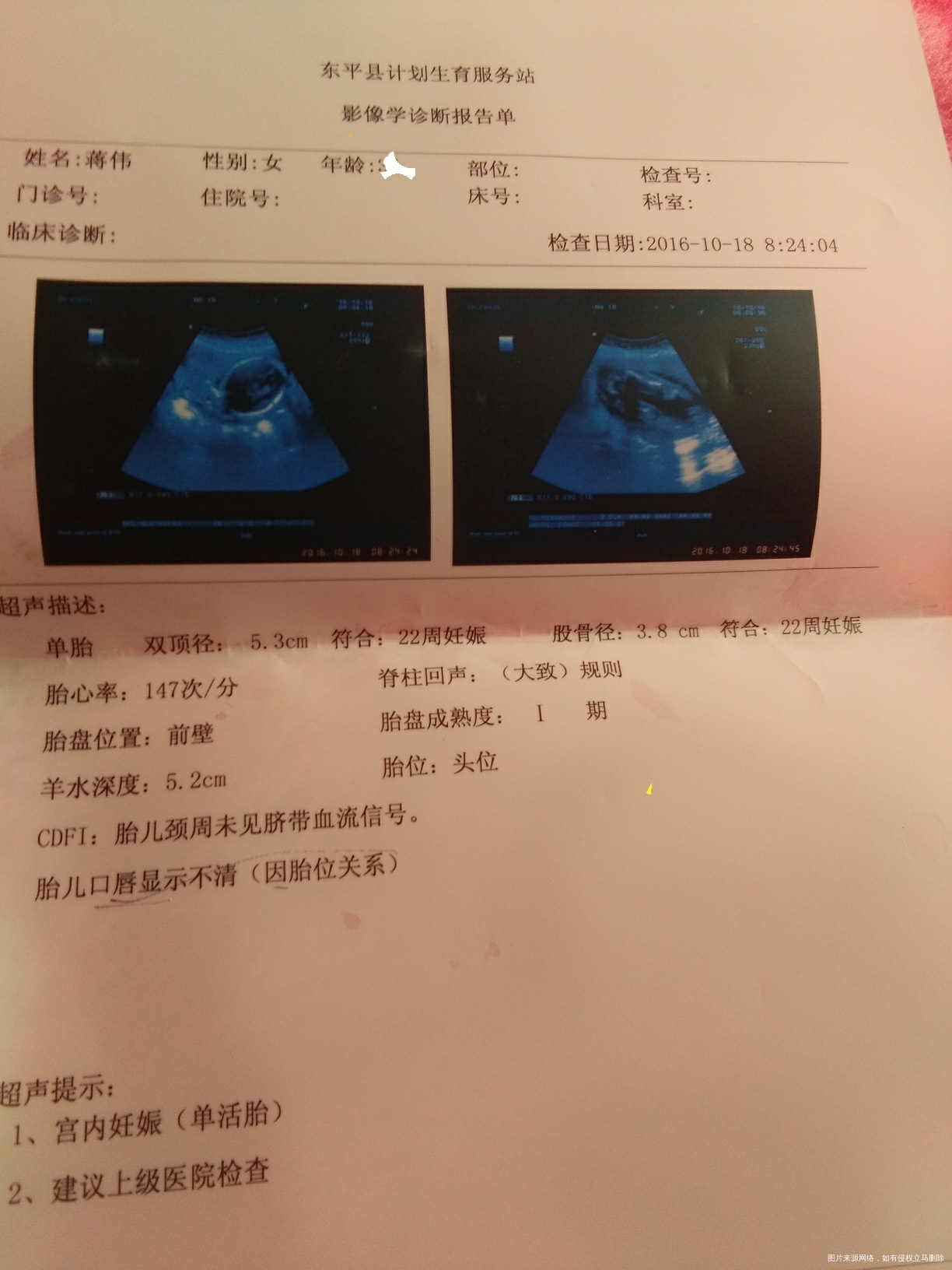 有在线的医生帮忙看看胎儿几斤了谢谢