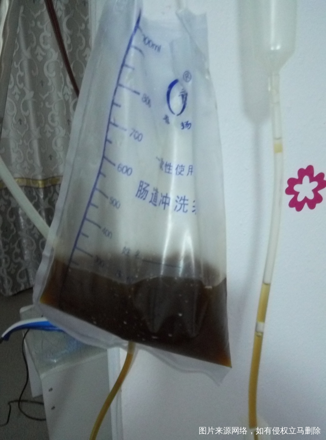 又开始灌肠了。为了要宝宝,忍了。。。