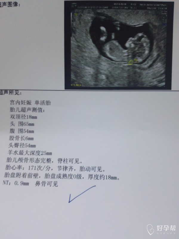 亲,3个月今天做的nt,能看出男女吗?