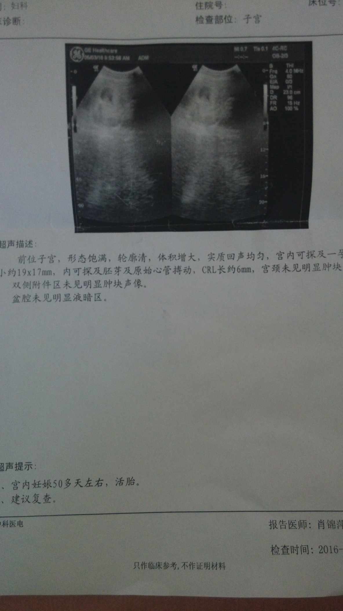 孕八周,今天b超了.crl是什么鬼?
