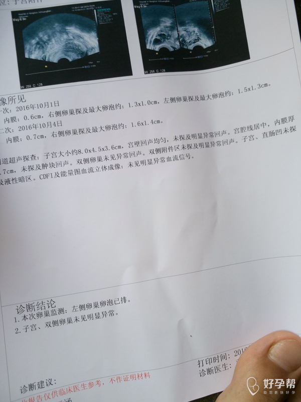 这是监测卵泡 大家帮我看看哦