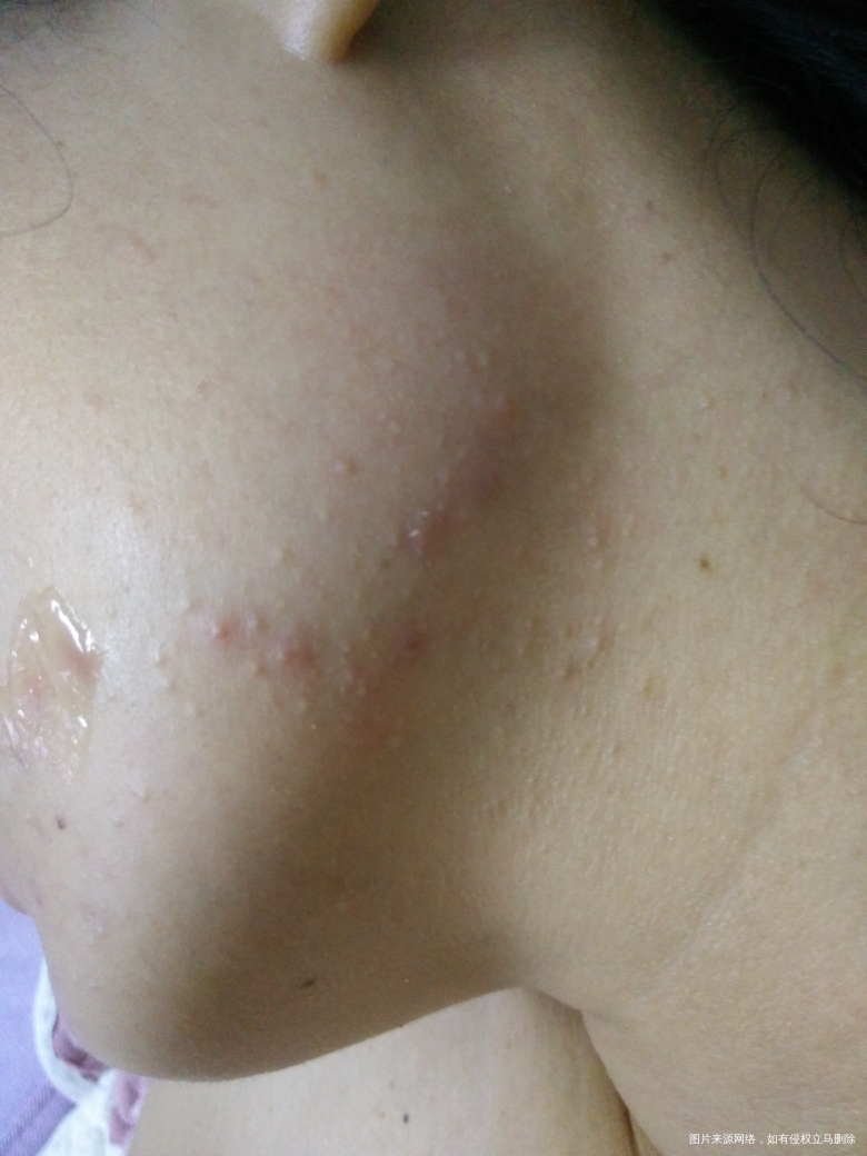 谁知道这是怎么回事呀?