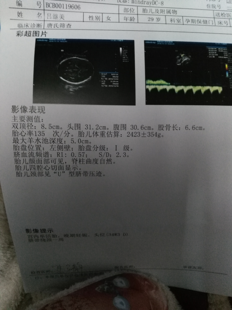怀孕八个月的b超图,看看是男是女!