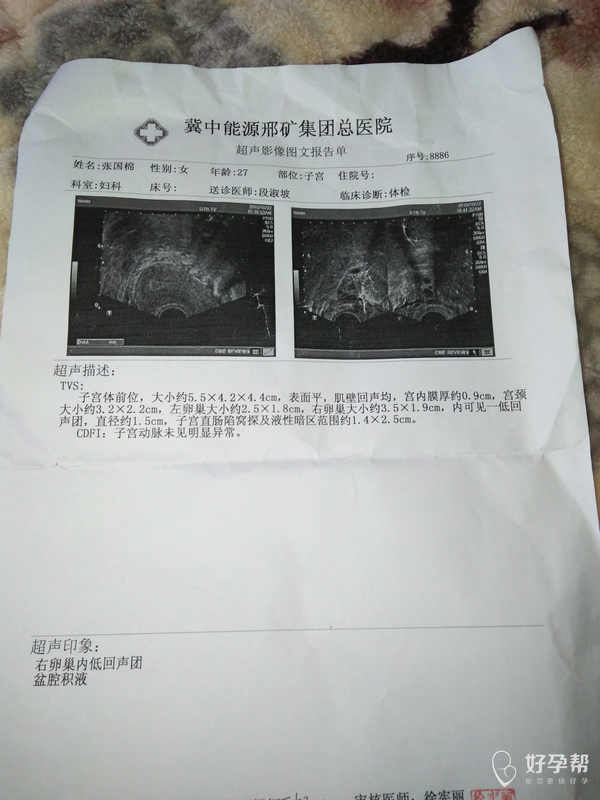 有卵巢内低回声团会是什么呢?