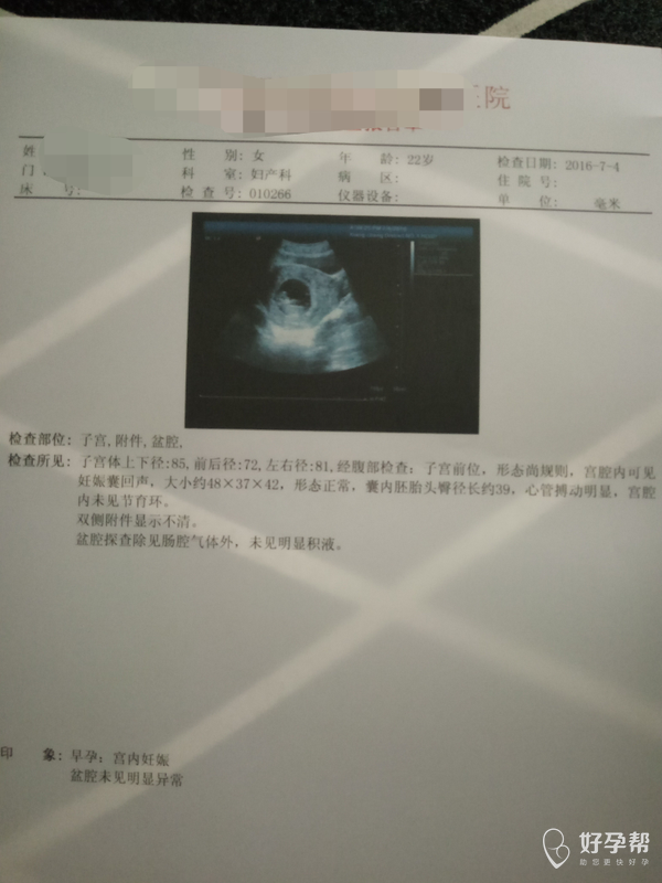 大家十周的b超宝宝多大(有图片)