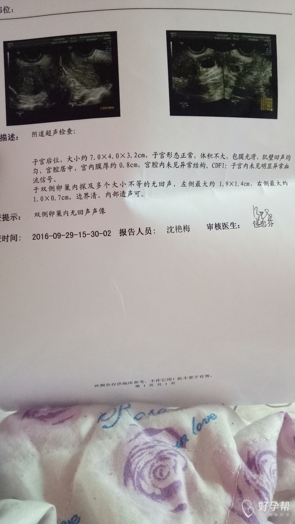 你能看懂阴道超声检查结果吗?