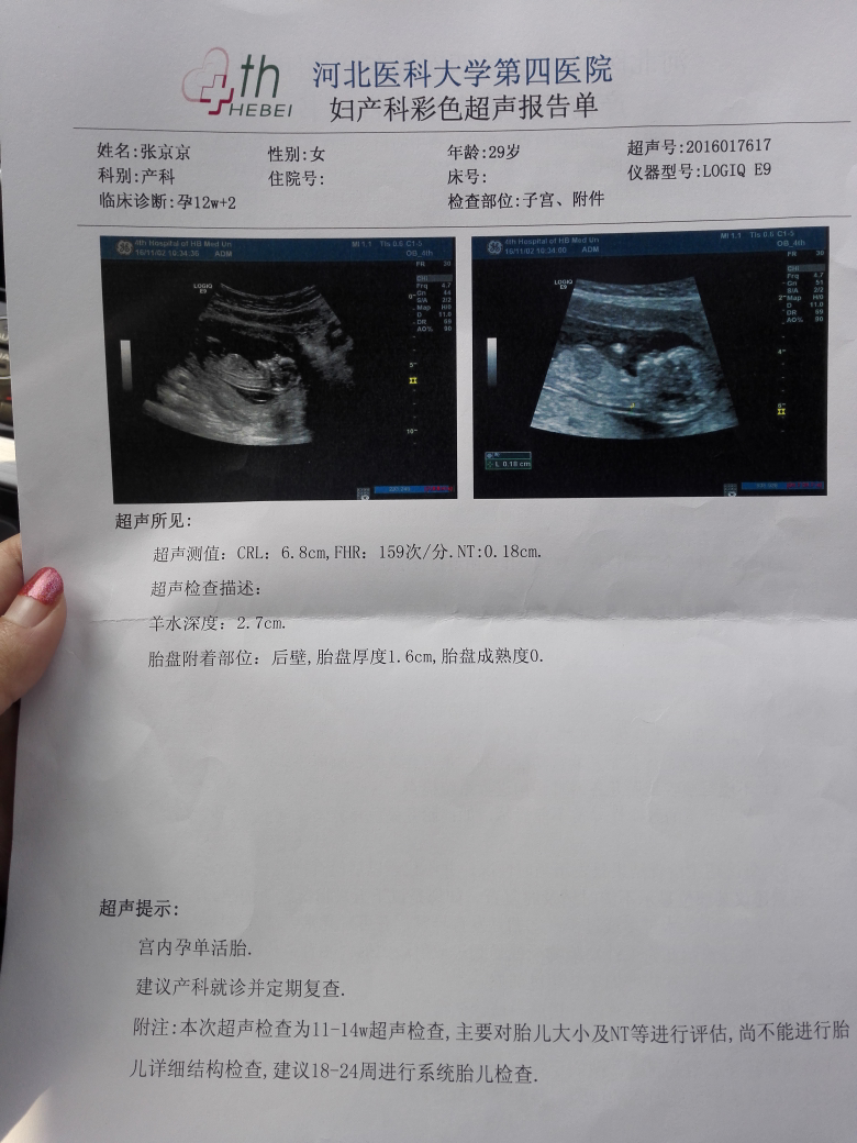nt过了 感谢宝宝给面子