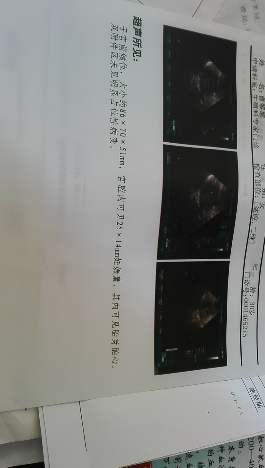 多囊备孕半年好孕,带给所有难孕姐妹们满满的正能量