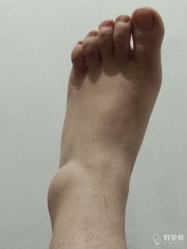 一个不小心,健康的小船就翻了