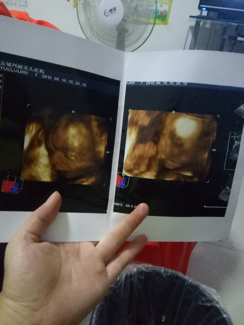 今天23 5做了4维彩超,偏小一周