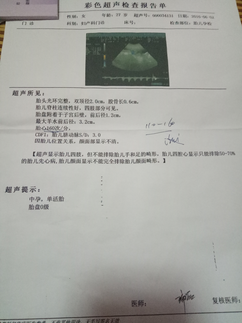 今天去建卡了,查了挺多的项目