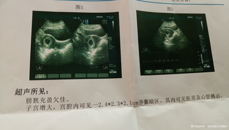 今天检查能看到胎心胚芽了,下次检查要什么时候?