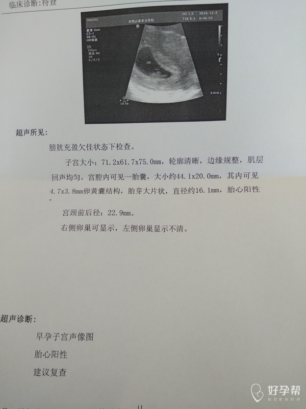 25 今天孕50天去做了彩超,拿给医生看结果医生不在,是护士给看的单子