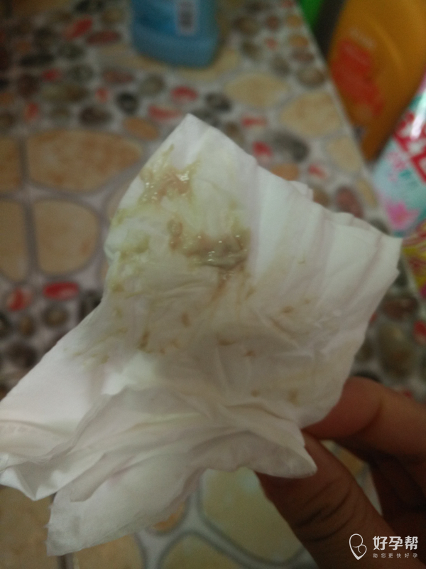 怀孕三个月了白带绿色带点红