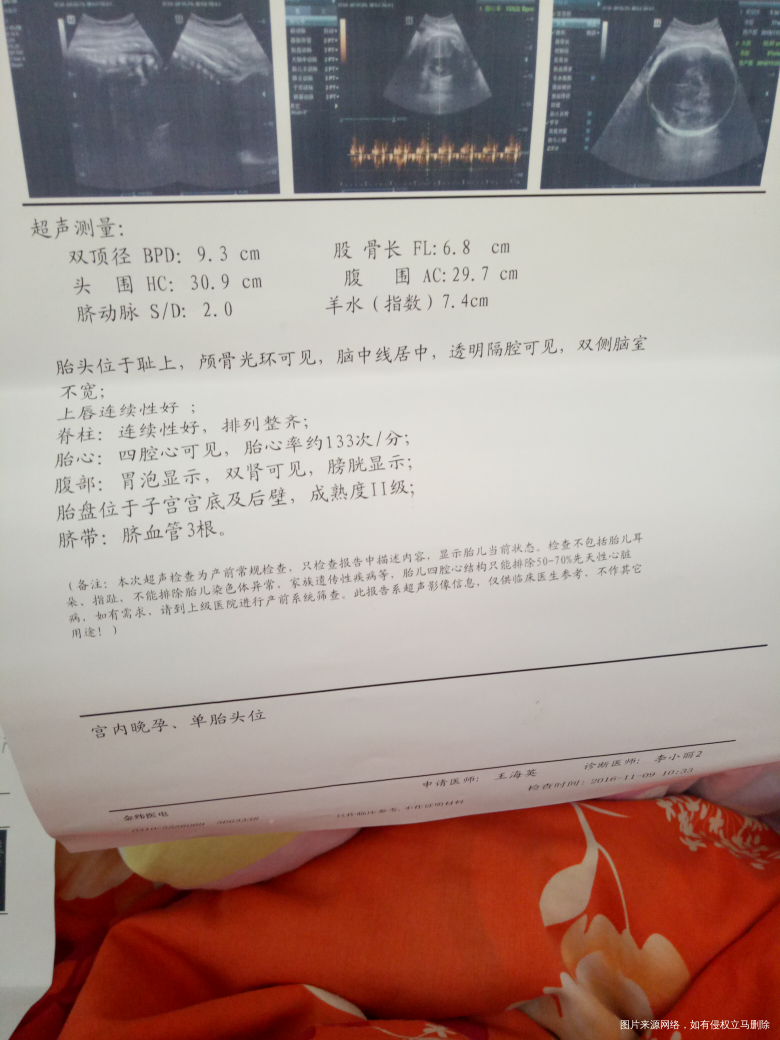 彩超检查差十天腹围变小了怎么回事,羊水也少了不在正常值