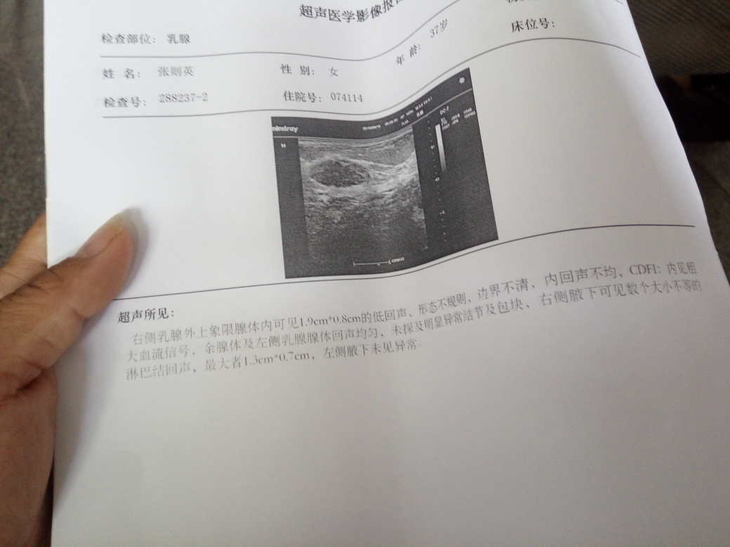 求助帮里的姐妹，医生帮我看看这是怎么回事啊