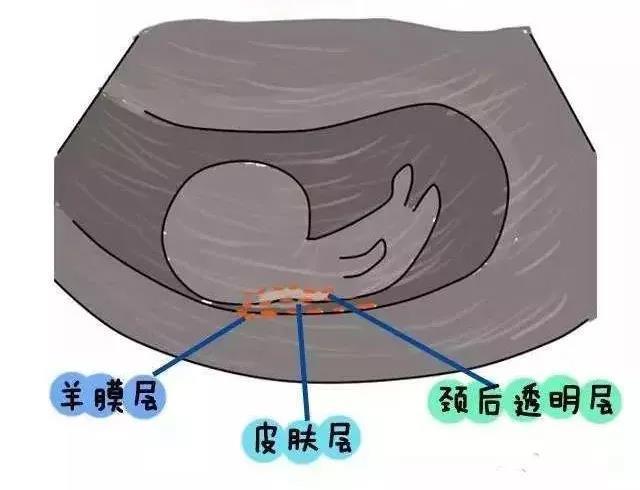 试管婴儿常见问题之 孕期篇(原创)