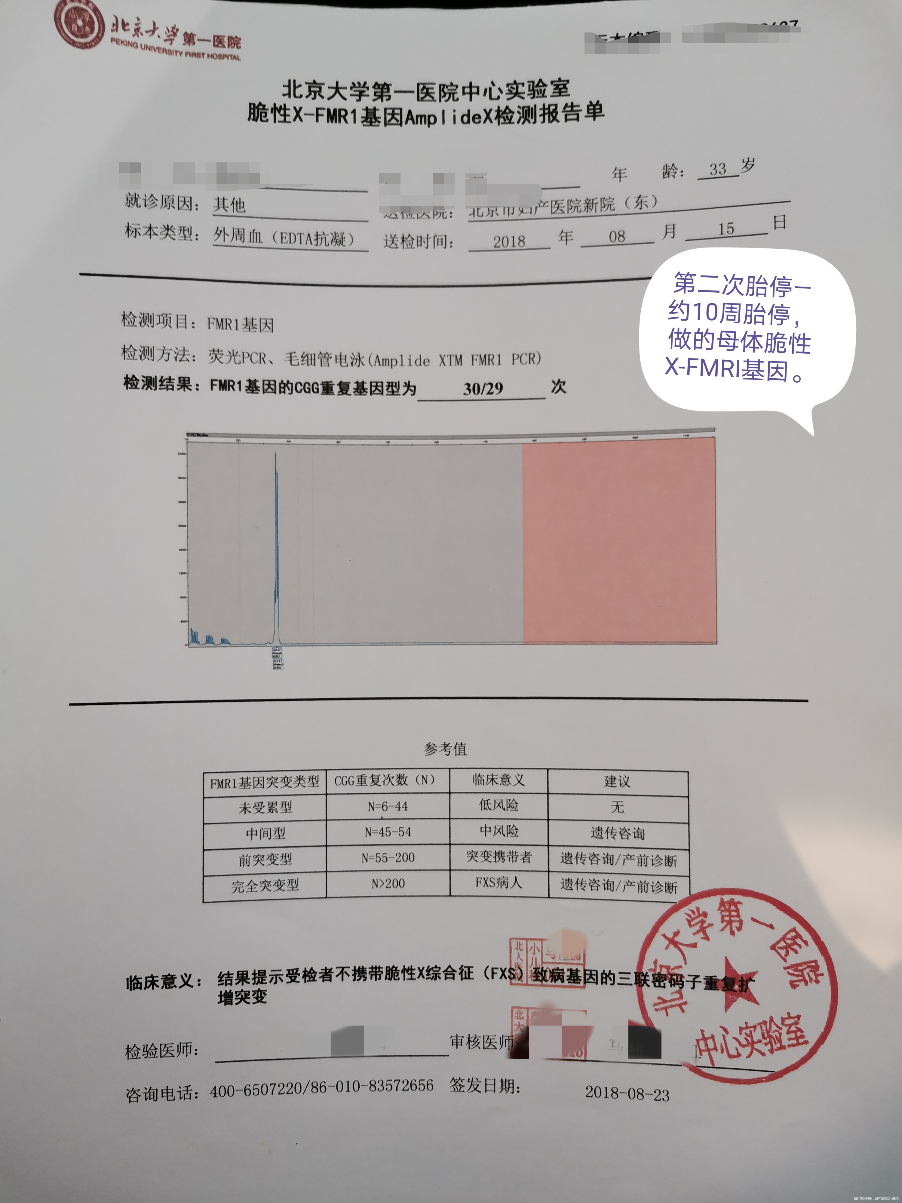 夫妻染色体正常 胚染有问题,45x。一次葡萄