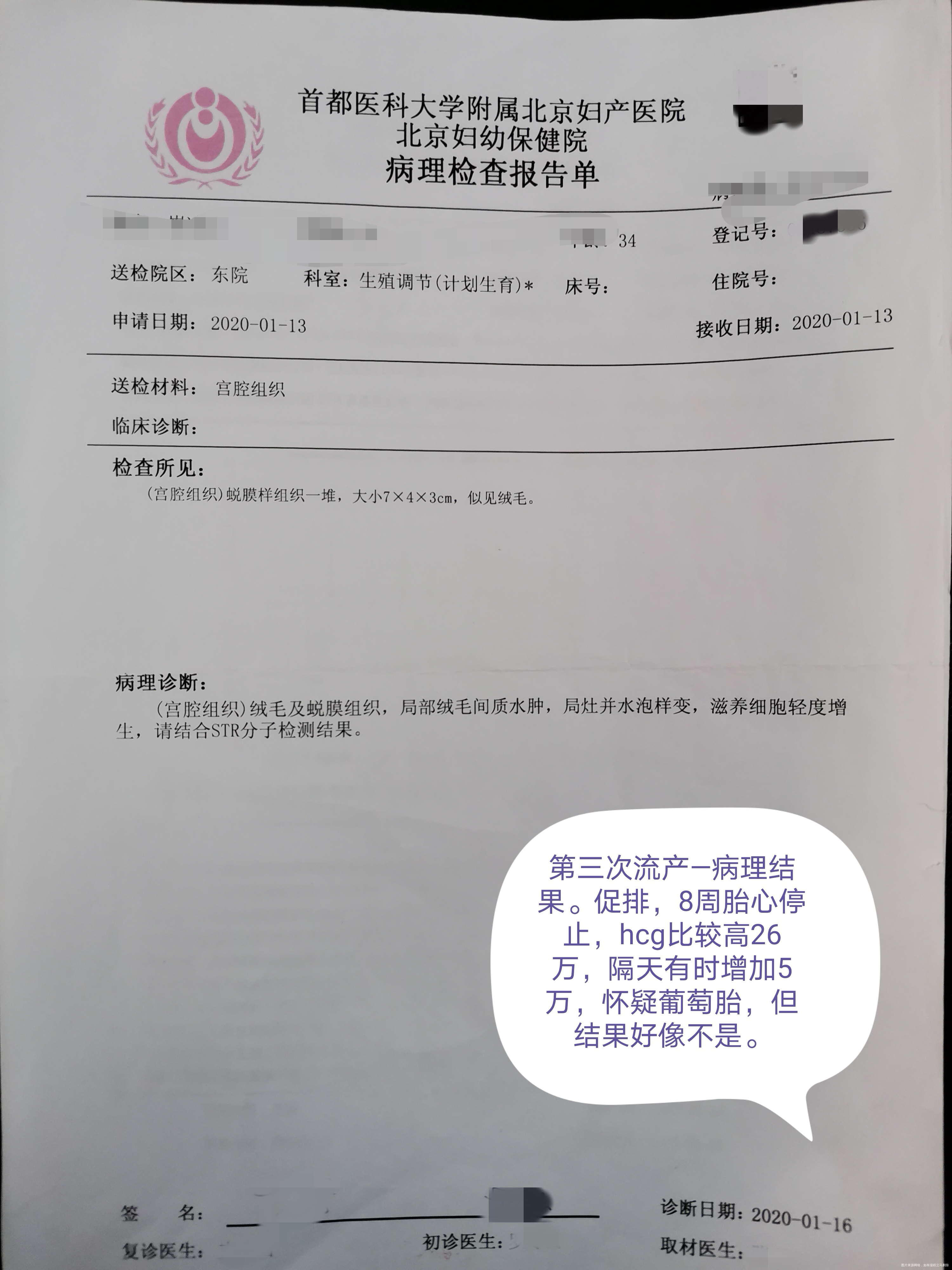 夫妻染色体正常 胚染有问题,45x。一次葡萄