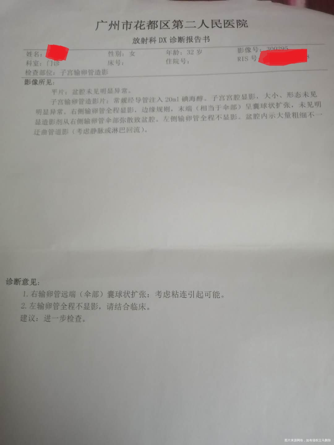 我还能做宫腔镜手术自然怀孕吗?当地医生都叫我