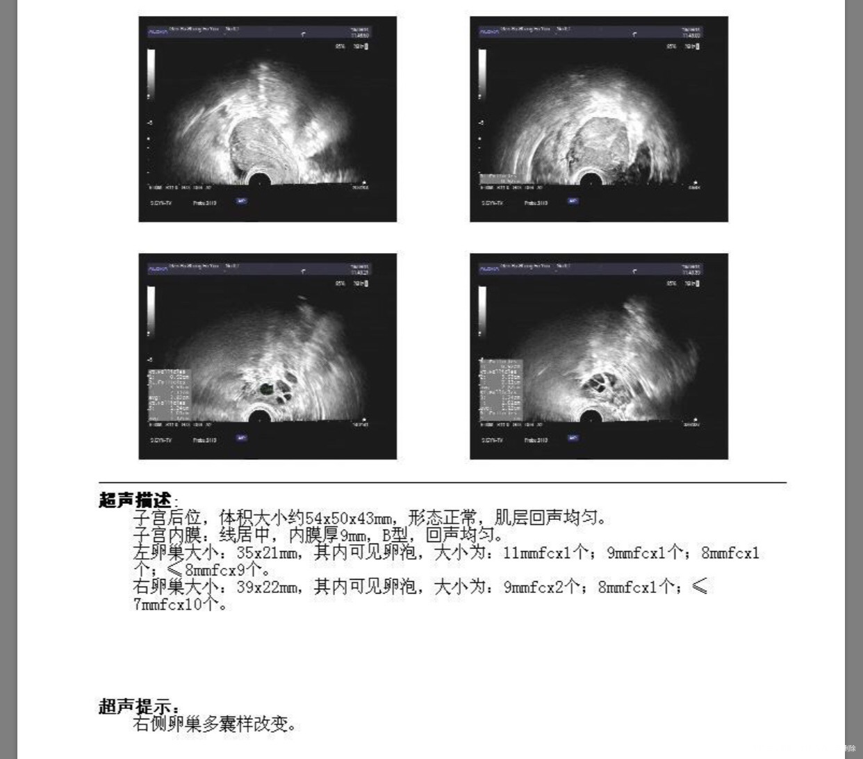 我是多囊患者,今年34.我这种情况该怎么治疗