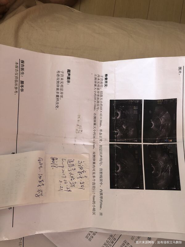 2017年查多囊 现在吃达英和中药。等半年复