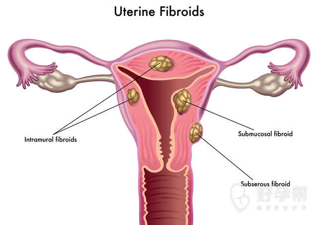 济宁哪家不育不孕好？试管成功率是否很低