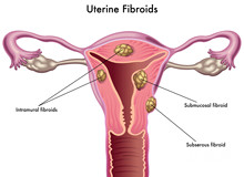 潍坊人民医院人工授精多少钱？可以报销吗？