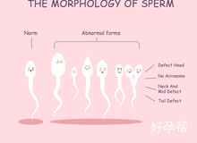 菏泽人工授精医院成功率数据是真实的吗?女性是否要进行手术