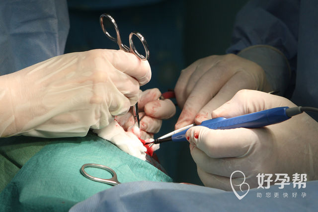 宝鸡生殖医院多少钱？什么人做试管更容易成功？