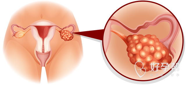 滨州人工授精医院价格表由什么决定？