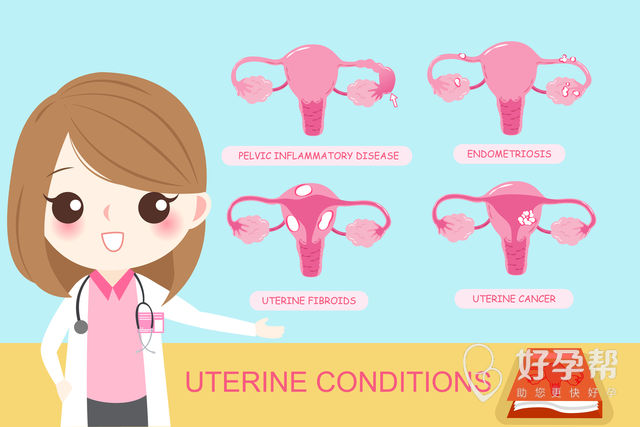 泉州人工授精哪个医院好？该注意哪些因素？