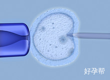 厦门第一医院人工授精费用是否很高?手术流程复杂吗