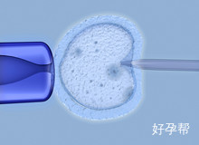 厦门第一医院人工授精费用是否很高？手术流程复杂吗