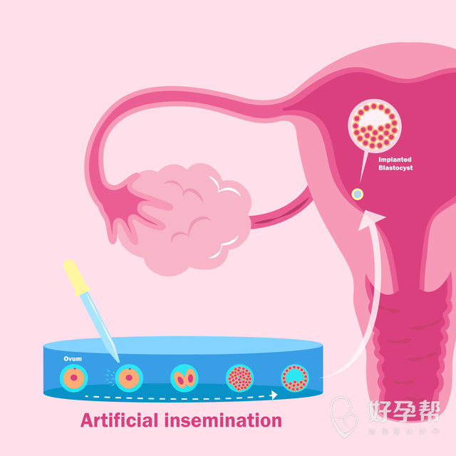 荆门人工授精医院哪家好？宝宝体质会很差吗