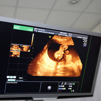 石家庄省四院和市四院哪个做试管好