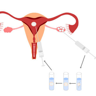 南京妇幼试管婴儿促排卵打针用进口还是国产