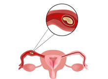 苏州做试管需要多少钱 苏州试管费用大概多少钱啊