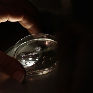 无菌慢性前列腺炎症状？无菌性前列腺炎会导致前列腺增生吗？