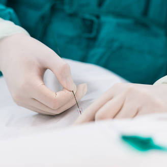 如何治疗慢性宫颈炎？慢性宫颈炎伴hpv感染怎么治疗？