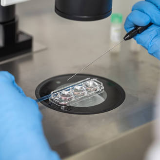 北京大学人民医院试管婴儿成功率、试管费用