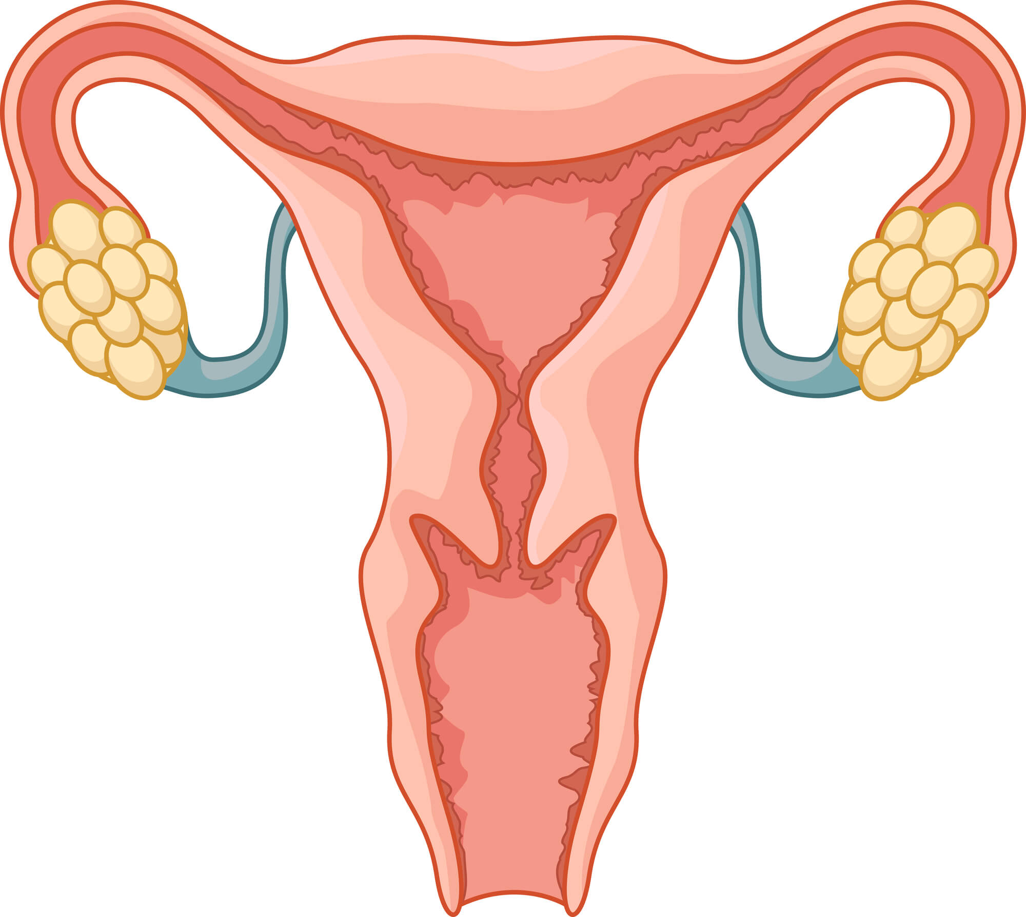 子宫内膜异位症的主要临床表现