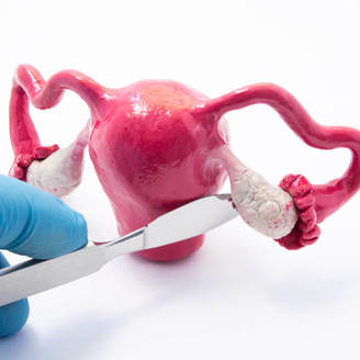 宫颈修复手术有伤害吗？宫颈修复手术后出血多久？