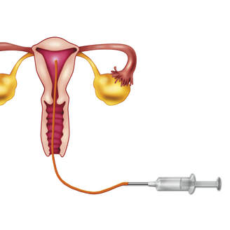子宫肌瘤恶性的b超结果？腹腔镜子宫肌瘤剔除术的适应症？