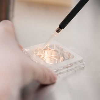 有生殖器疱疹能打宫颈癌疫苗吗？宫颈糜烂3度癌变概率大吗？