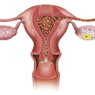 女性备孕造影：能否疏通输卵管及为何有助于怀孕