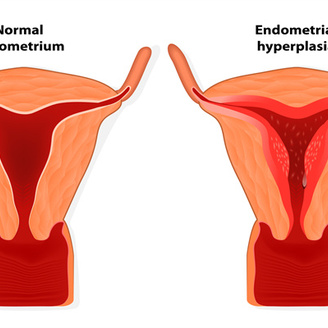 输卵管检查是怎么检查的?检查一次大概需多少钱?