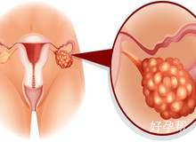 热点资讯：试管输卵管检查的最佳时间与准备事项