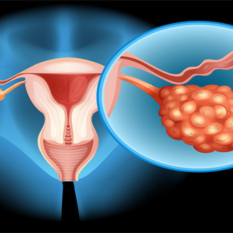 女性多囊卵巢可以受孕吗?多囊卵巢能怀上孩子的几率有多大?